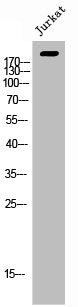 Western Blot analysis of Jurkat cells using ErbB-3 Polyclonal Antibody