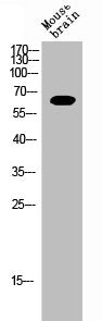 Western Blot analysis of MOUSE-BRAIN cells using ERα Polyclonal Antibody