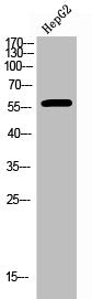 Western Blot analysis of HepG2 cells using Phospho-ERβ (S105) Polyclonal Antibody