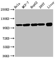 Western Blot Positive WB detected in: Hela whole cell lysate, MCF-7 whole cell lysate, HepG2 whole cell lysate, 293T whole cell lysate, Rat liver tissue All lanes: ACTN4 antibody at 3.3µg/ml Secondary Goat polyclonal to rabbit IgG at 1/50000 dilut...