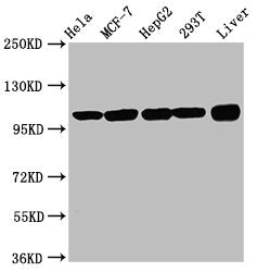 Western Blot Positive WB detected in: Hela whole cell lysate, MCF-7 whole cell lysate, HepG2 whole cell lysate, 293T whole cell lysate, Rat liver tissue All lanes: ACTN4 antibody at 3.3µg/ml Secondary Goat polyclonal to rabbit IgG at 1/50000 dilut...