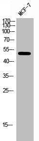 Western Blot analysis of MCF-7 cells using ERβ Polyclonal Antibody