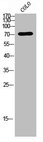 Western Blot analysis of COLO cells using Factor XIII B Polyclonal Antibody