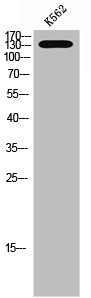Western Blot analysis of K562 cells using Phospho-PYK2 (Y580) Polyclonal Antibody