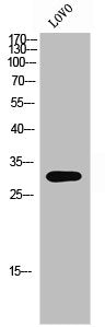 Western Blot analysis of LOVO cells using Olfactory receptor 8K3 Polyclonal Antibody