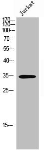 Western Blot analysis of Jurkat cells using Olfactory receptor 8J1 Polyclonal Antibody