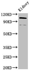 Western Blot Positive WB detected in: Mouse kidney tissue All lanes: ACTN4 antibody at 3.4ug/ml Secondary Goat polyclonal to rabbit IgG at 1/50000 dilution Predicted band size: 105, 80, 60 kDa Observed band size: 105, 80 kDa