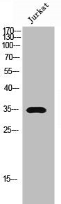 Western Blot analysis of Jurkat cells using Olfactory receptor 5AR1 Polyclonal Antibody