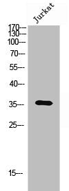 Western Blot analysis of Jurkat cells using Olfactory receptor 6Q1 Polyclonal Antibody