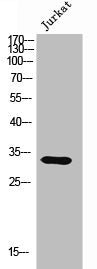 Western Blot analysis of Jurkat cells using Olfactory receptor 9Q1 Polyclonal Antibody