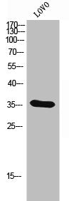 Western Blot analysis of LOVO cells using Olfactory receptor 4D6 Polyclonal Antibody