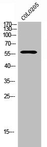 Western Blot analysis of COLO205 cells using GPR114 Polyclonal Antibody