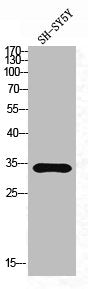 Western Blot analysis of SH-SY5Y cells using CD32 Polyclonal Antibody