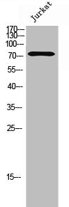 Western Blot analysis of Jurkat cells using FoxK1 Polyclonal Antibody