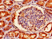 Immunohistochemistry of paraffin-embedded human kidney tissue using CSB-PA008226LA01HU at dilution of 1:100
