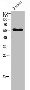 Western Blot analysis of Jurkat cells using CGI-43 Polyclonal Antibody