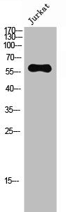 Western Blot analysis of Jurkat cells using Phospho-ERK 8 (T175/Y177) Polyclonal Antibody