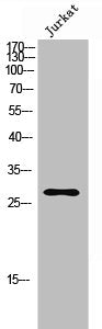 Western Blot analysis of JK cells using FGF-13 Polyclonal Antibody