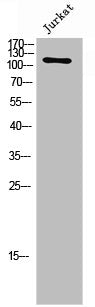 Western Blot analysis of JK cells using Flg/Bek Polyclonal Antibody