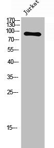 Western Blot analysis of JK cells using Phospho-FGFR-4 (Y642) Polyclonal Antibody