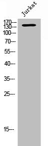 Western Blot analysis of JK cells using RBM16 Polyclonal Antibody