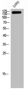 Western Blot analysis of LOVO cells using KPI-2 Polyclonal Antibody