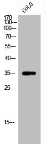 Western Blot analysis of CoLo cells using Raly Polyclonal Antibody