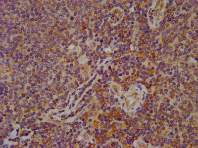 IHC image of CSB-PA008279LA01HU diluted at 1:600 and staining in paraffin-embedded human lymph node tissue performed on a Leica BondTM system. After dewaxing and hydration, antigen retrieval was mediated by high pressure in a citrate buffer (pH 6....