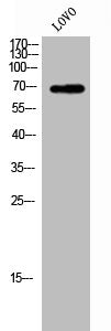 Western Blot analysis of LOVO cells using ZP1 Polyclonal Antibody
