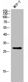 Western Blot analysis of MCF-7 cells using Rab 18 Polyclonal Antibody