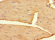 Immunohistochemistry of paraffin-embedded human skeletal muscle tissue using CSB-PA008285LA01HU at dilution of 1:100