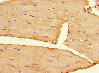 Immunohistochemistry of paraffin-embedded human skeletal muscle tissue using CSB-PA008285LA01HU at dilution of 1:100