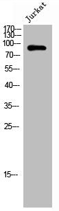 Western Blot analysis of Jurkat cells using TPX2 Polyclonal Antibody
