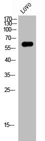 Western Blot analysis of LOVO cells using FoxJ1 Polyclonal Antibody