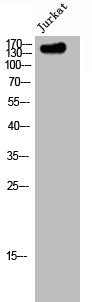 Western Blot analysis of Jurkat cells using NACAD Polyclonal Antibody