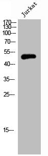 Western Blot analysis of JK cells using Septin 6 Polyclonal Antibody