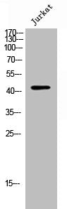 Western Blot analysis of Jurkat cells using Atg4b Polyclonal Antibody