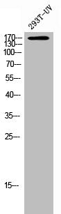 Western Blot analysis of 293T-UV cells using Phospho-Flt-3 (Y842) Polyclonal Antibody