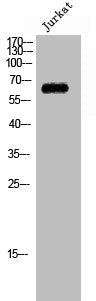Western Blot analysis of Jurkat cells using CstF-64T Polyclonal Antibody