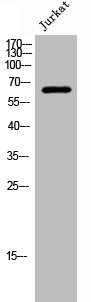 Western Blot analysis of Jurkat cells using NHE-8 Polyclonal Antibody