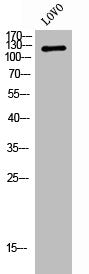 Western Blot analysis of LOVO cells using ADNP Polyclonal Antibody