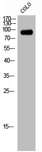 Western Blot analysis of COLO cells using hCAP-H Polyclonal Antibody