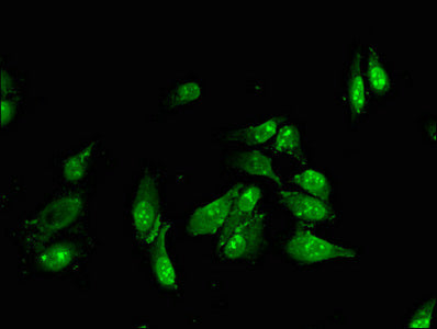 Immunofluorescent analysis of Hela cells using CSB-PA008413LA01HU at dilution of 1:100 and Alexa Fluor 488-congugated AffiniPure Goat Anti-Rabbit IgG(H+L)