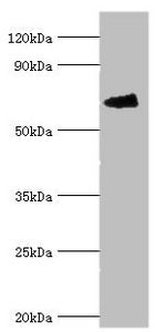 Western blot All lanes: Fanconi anemia group G protein antibody at 4ug/ml + Mouse gonad tissue Secondary Goat polyclonal to rabbit IgG at 1/10000 dilution Predicted band size: 69 kDa Observed band size: 69 kDa