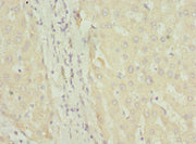 Immunohistochemistry of paraffin-embedded human liver tissue using CSB-PA008436ESR1HU at dilution of 1:100