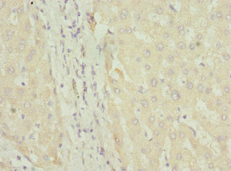 Immunohistochemistry of paraffin-embedded human liver tissue using CSB-PA008436ESR1HU at dilution of 1:100