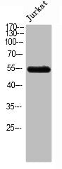 Western Blot analysis of Jurkat cells using CARKL Polyclonal Antibody