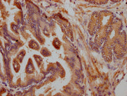 IHC image of CSB-PA008452LA01HU diluted at 1:200 and staining in paraffin-embedded human prostate tissue performed on a Leica BondTM system. After dewaxing and hydration, antigen retrieval was mediated by high pressure in a citrate buffer (pH 6.0)...