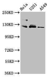 Western Blot Positive WB detected in: Hela whole cell lysate, U251 whole cell lysate, A549 whole cell lysate All lanes: FBLN2 antibody at 3.4µg/ml Secondary Goat polyclonal to rabbit IgG at 1/50000 dilution Predicted band size: 127, 132 kDa Observ...