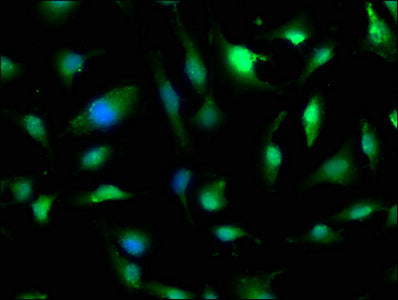 Immunofluorescence staining of U251 cells with CSB-PA008457LA01HU at 1:200, counter-stained with DAPI. The cells were fixed in 4% formaldehyde, permeabilized using 0.2% Triton X-100 and blocked in 10% normal Goat Serum. The cells were then incubat...